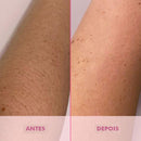 Depilador Definitivo com Tecnologia IPL